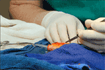 Goldfish Surgery